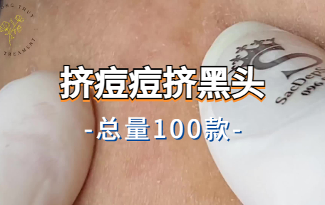 【100款】挤痘痘挤黑头解压视频素材-零八素材网